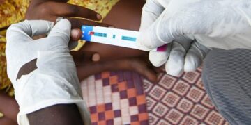  Les femmes toujours principales victimes du sida en Afrique subsaharienne